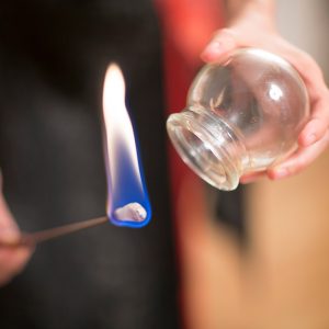 Masaje con fuego (Quierotermia 30min -1h y 40min)